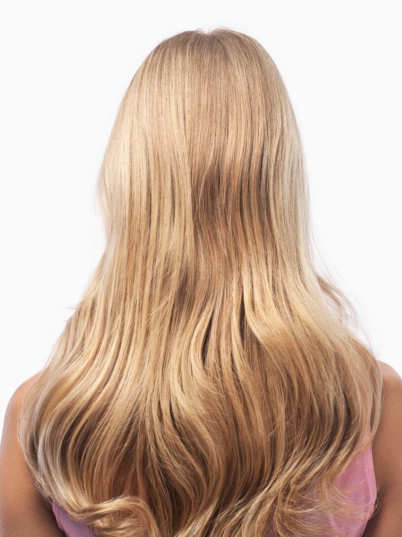 Os sintomas da alopecia areata